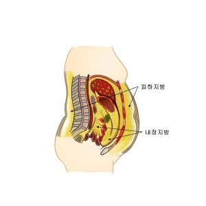 내장지방