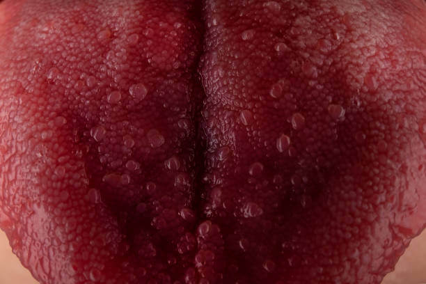 구강암 초기증상