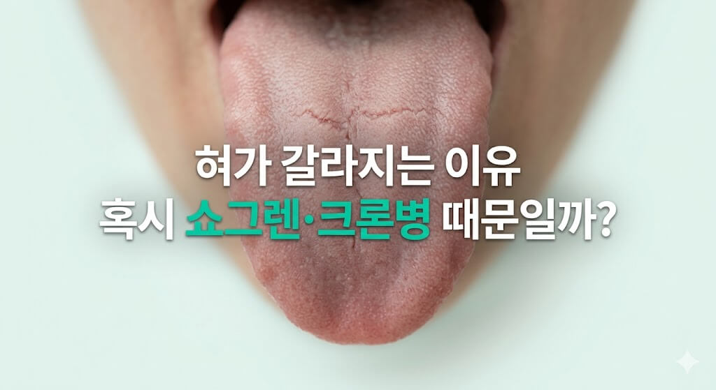 혀 표면에 균열이 생긴 모습과 함께 열구설과 전신 건강의 연관성을 나타낸 썸네일 이미지