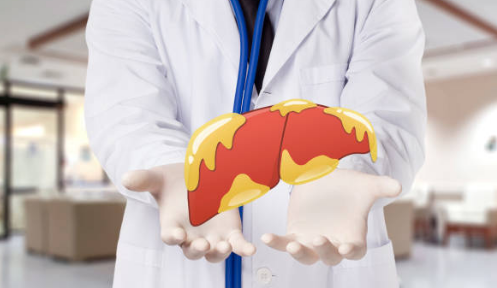 지방간 증상, 없애는 방법, 원인 총정리 (2024ver)