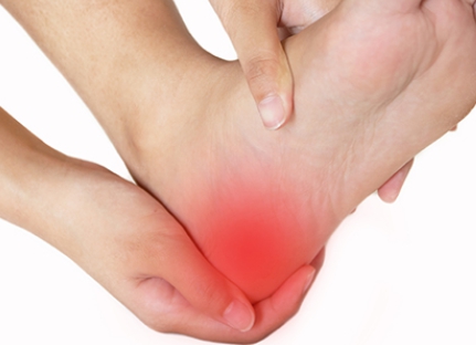 다양한 부위에서 발생하는 좌골신경통 통증 가운데 발바닥에서 발생하는 통증을 표현한 이미지입니다.