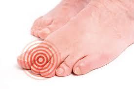 발바닥이 화끈거리는 이유