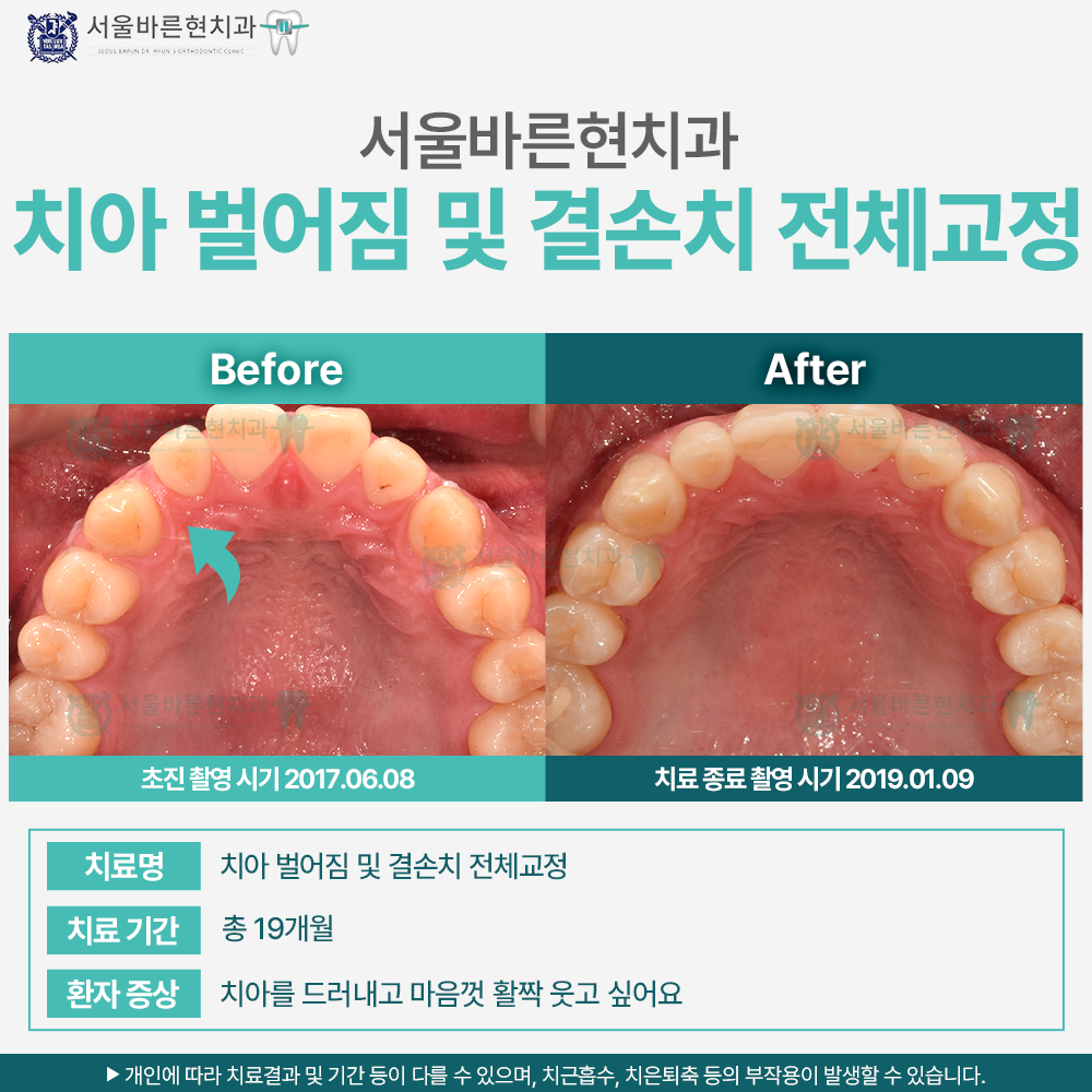 해운대치아교정