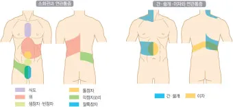 배를 콕콕 찌르는 통증의 8가지 원인 하는법 알아보기로 정리_9