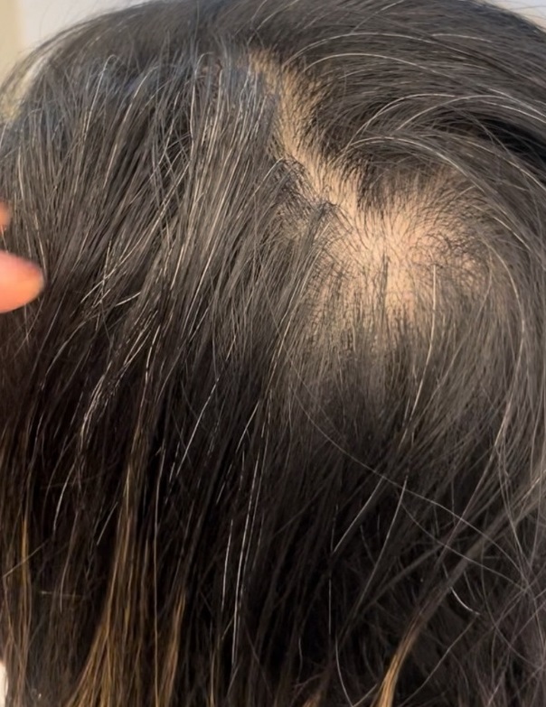 이진용-하프발레아쥬-순수반포실버점