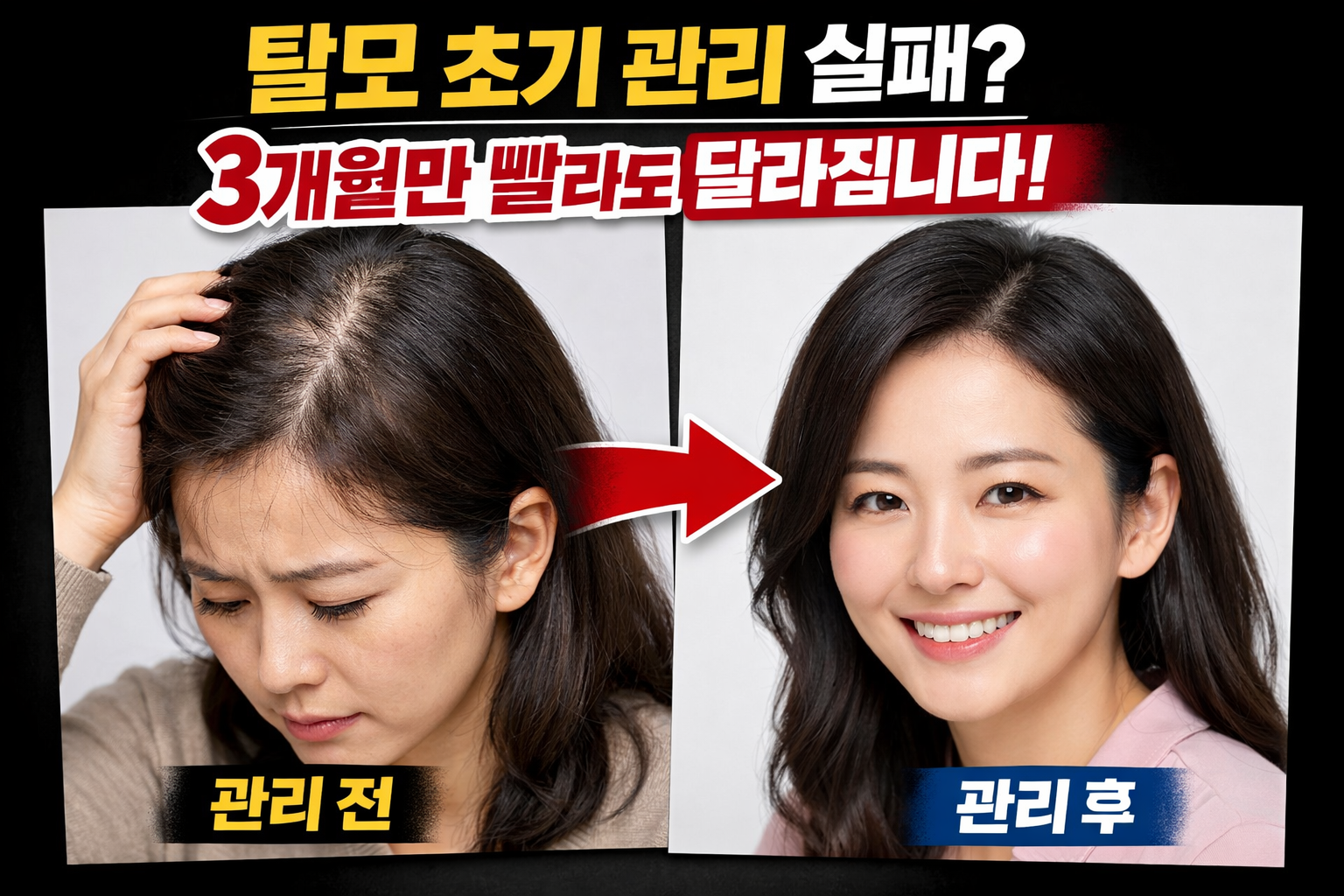 탈모 초기 관리 실패