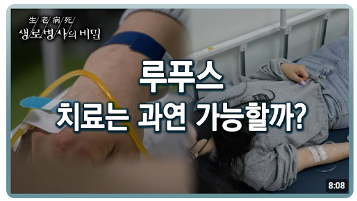 루프스치료 동영상