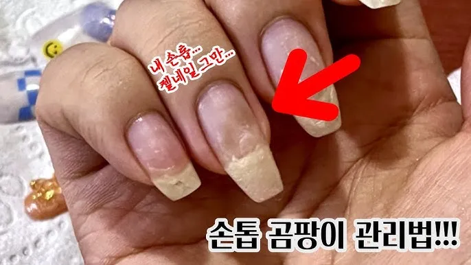 장마철 곰팡이 제거방법 꿀팁 정리 완벽 가이드_6