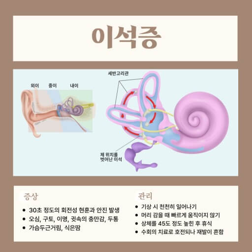이석의 위치