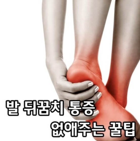 족저근막염 진단 예방 치료 알아보기