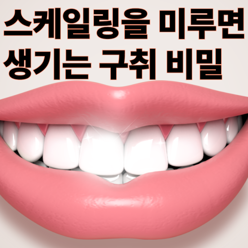 스케일링 미루면 생기는 구취의 비밀