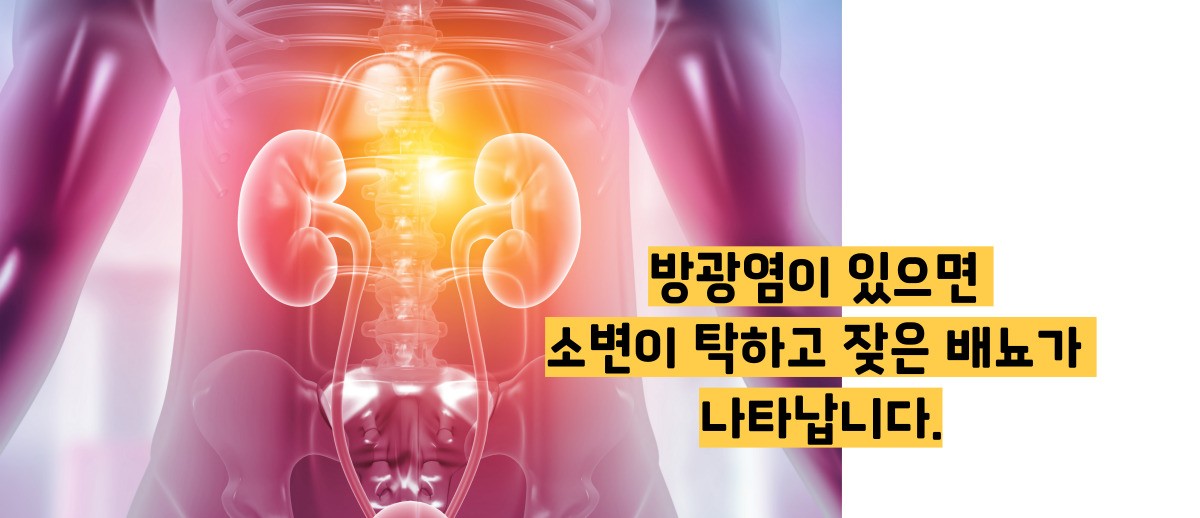 소변이 탁한이유