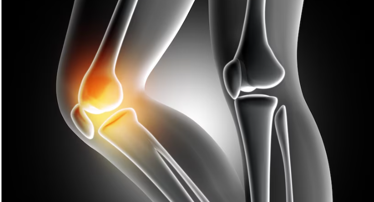 피부가 쉽게 멍들고 잘 늘어난다면 이증상 의심해봐요