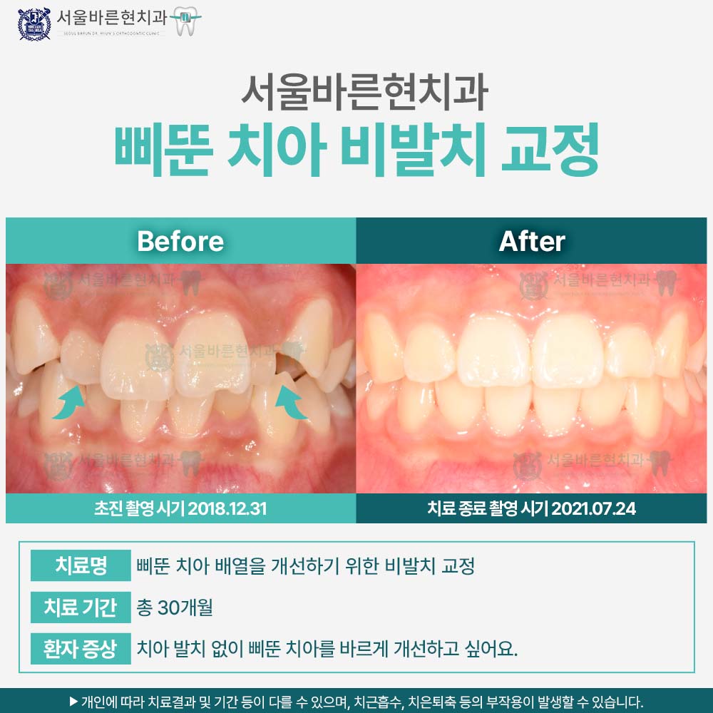부산교정치과