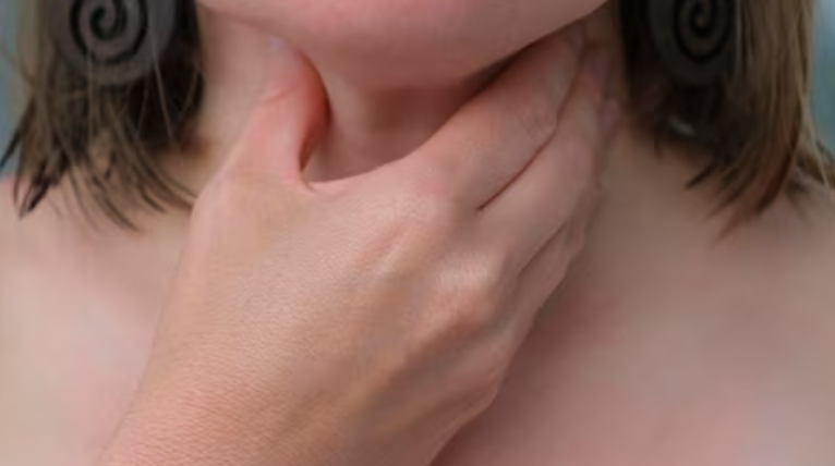 갑상선 기능 저하증 치료