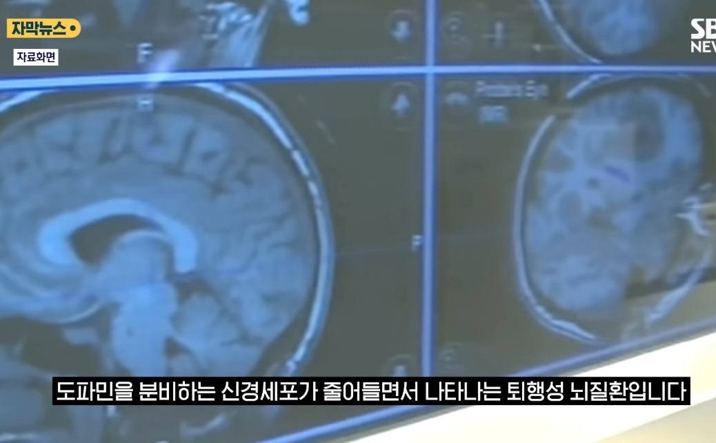 EBS-명의-파킨슨