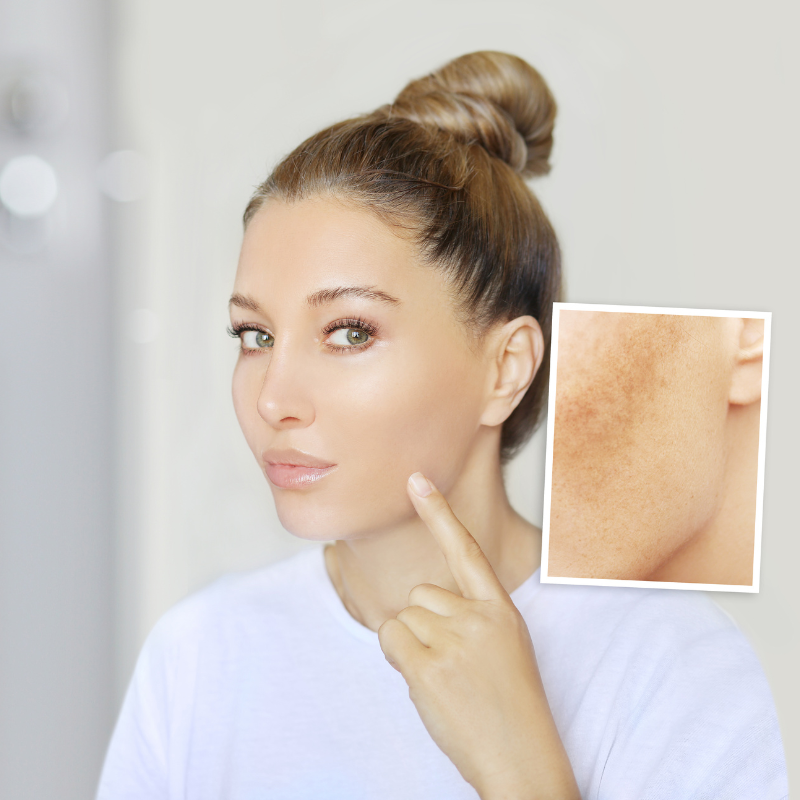 글루타치온 효능 부작용