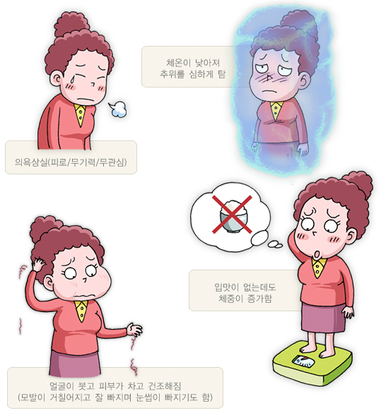 갑상선 기능 저하증의 증상