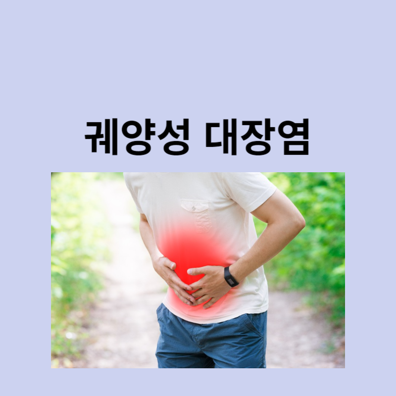 궤양성 대장염