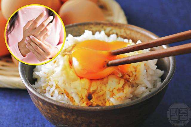 손가락 손바닥 찌릿찌릿 저림,손목터널증후군 증상