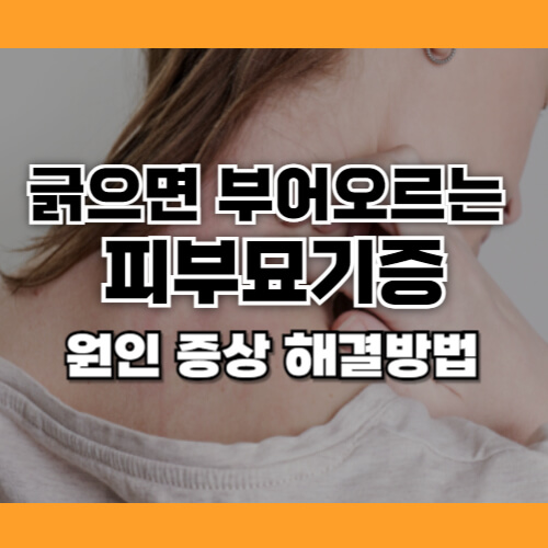 피부 묘기증 원인
피부 가려움 부어오름
피부 묘기증 연고
피부 가렵고 부어오름 이유
피부 묘기증 해결 방법
피부 자극 가려움 완화
항히스타민제 피부 묘기증
피부 묘기증 치료
피부 묘기증 예방