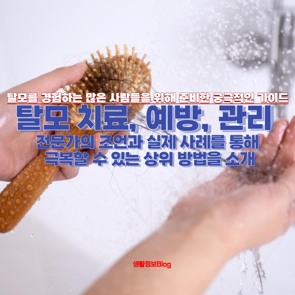 탈모를 경험하는 많은 사람들을 위해 준비한 궁극적인 가이드