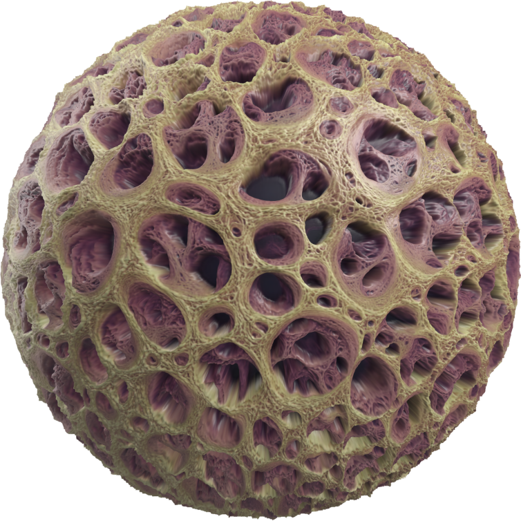Porous bone tissue4