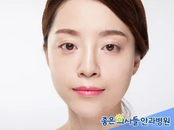 눈물이 자주 나는 이유에 대한 안과정보_18