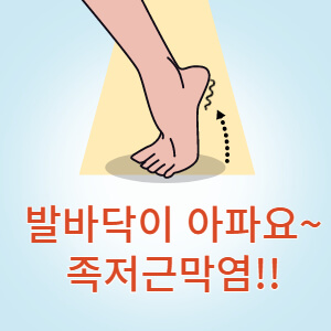 근족막염, 족막근저염 썸네일