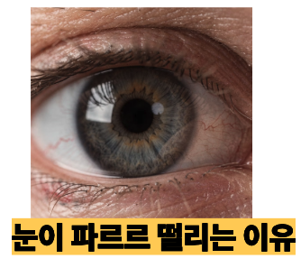 눈떨림 이유