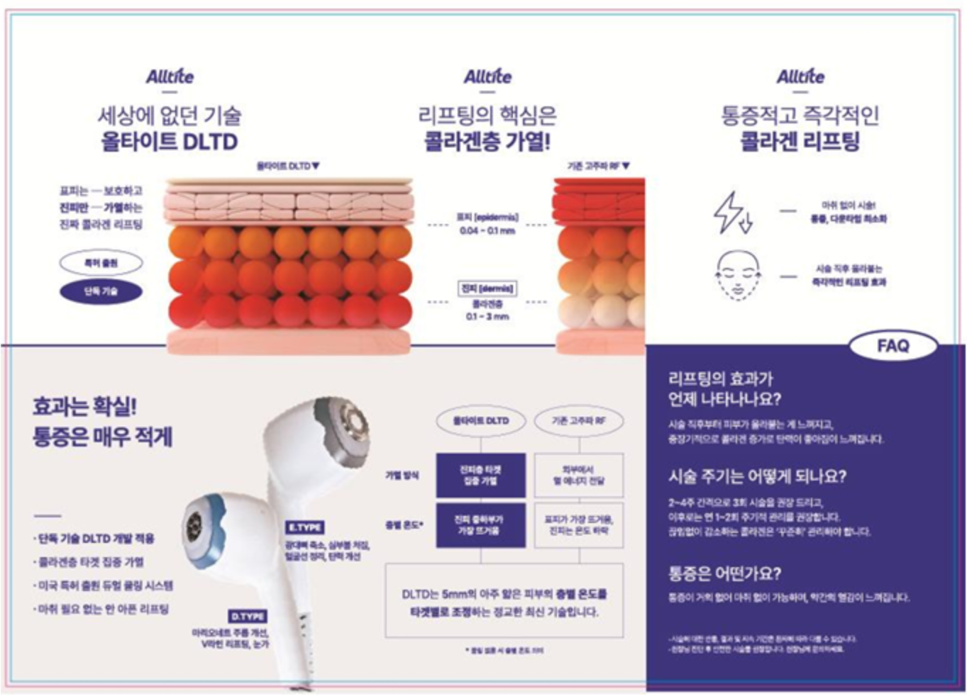올타이트 리프팅