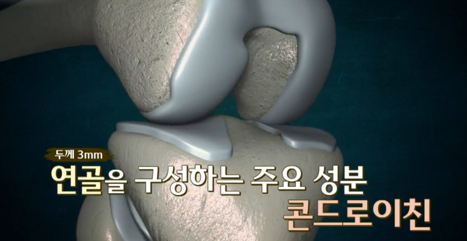 콘드로이친
