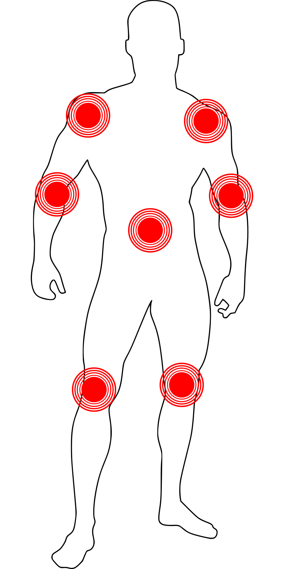 기가 막히게 되면서 우리 몸의 여러 부분에서 나타날 수 있는 통증 부위를 형상화한 그림