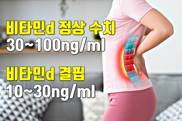 비타민d 결핍 증상 비타민d권장량 허리통증 근육통 관절염