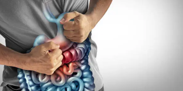 크론병과 관련된 사진