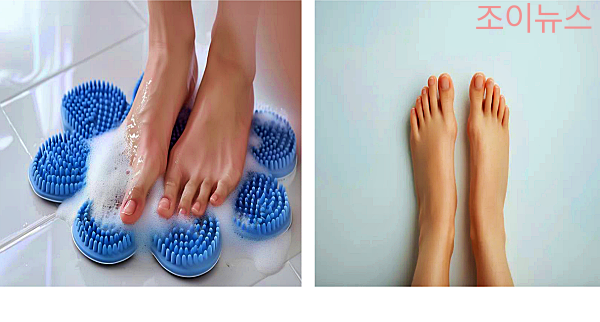 내성발톱 발 위생 관리하기