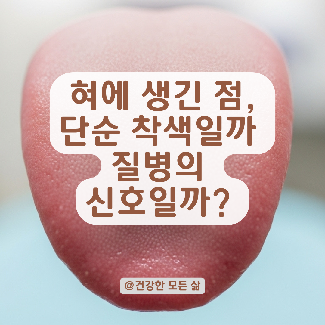 혀에 생긴 이상한 점, 자주 나타나는 원인부터 구강질환까지 정리.