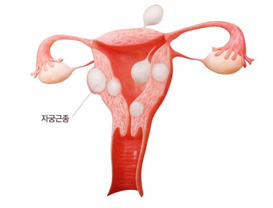달맞이꽃종자유-효능