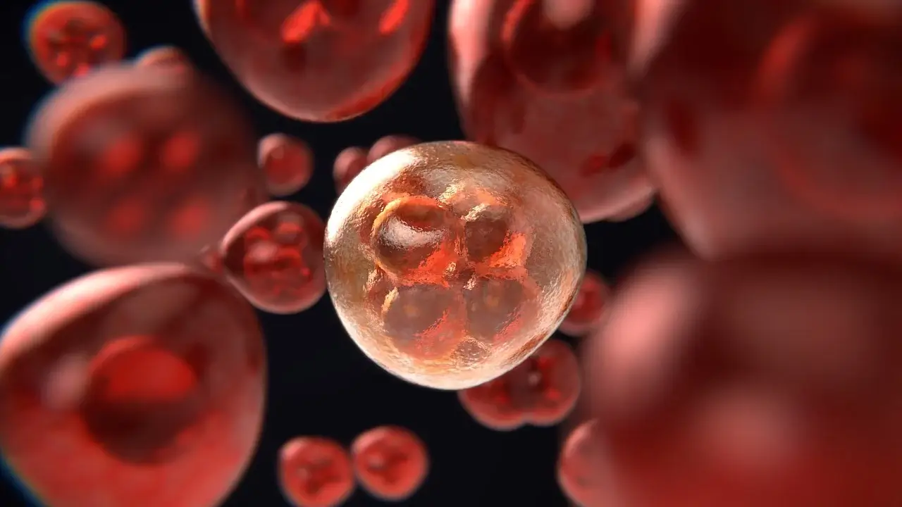겸상적혈구빈혈(Sickle Cell Anemia) : 원인, 증상, 진단 및 치료