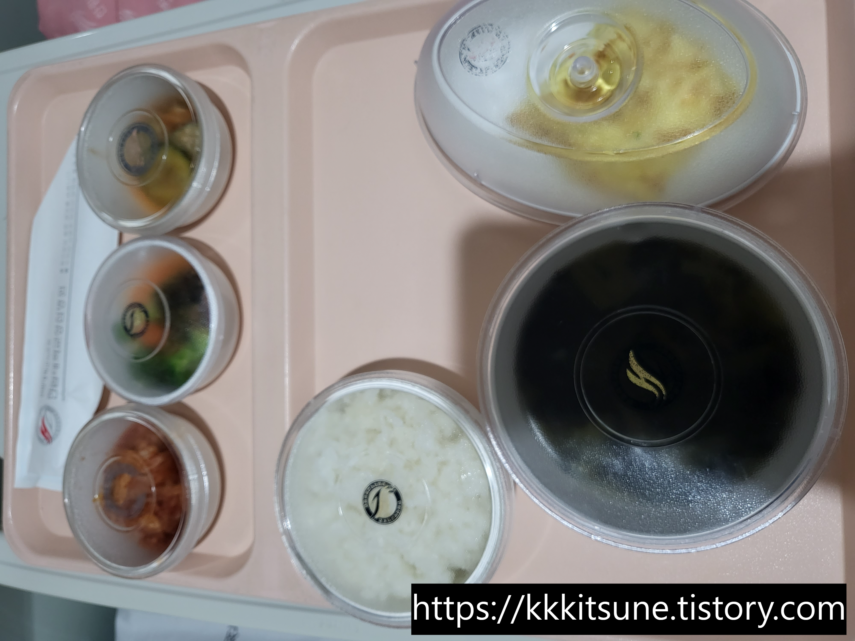 평촌 한림대성심병원 목디스크 수술 후 거의 마지막 식사