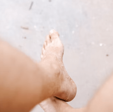 발톱무좀 없애는 방법 - 예방 청결 유지