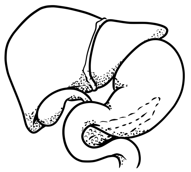 췌장암 위험 식습관 (가공육, 당음료, 과음) 관련 사진