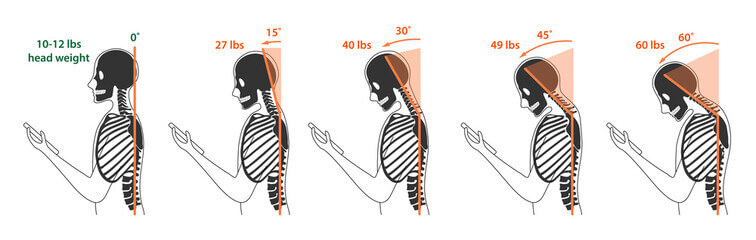 뒷목 땡김 이 있는 두통 여러가지 원인들이 있습니다. 두통이 있을 때 목 뒤가 따끔거리는 느낌이 들고 어깨 승모근이 뭉쳐져있습니다. 근육이완제와 진통제를 자주 복용하고 어깨를 마사지해도 뒷머리가 쪼개지거나 머리 전체가 터질 것 같은 두통이 계속된다면 매우 힘듭니다. 원인이 무엇인지 참고하시기 바랍니다.