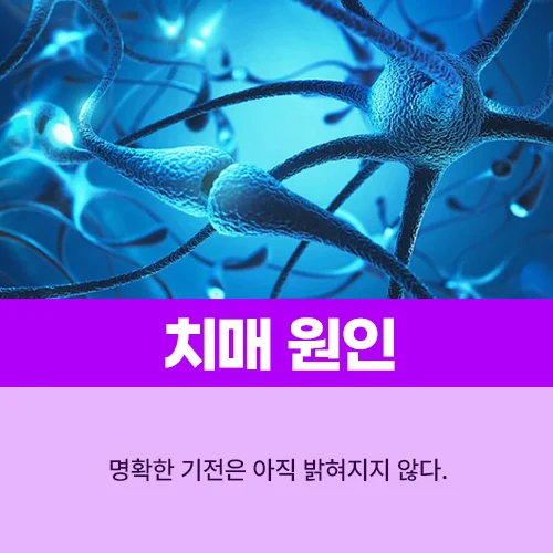 알츠하이머 치료제