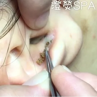 남자 얼굴 피지 제거 화장품 꿀템_14