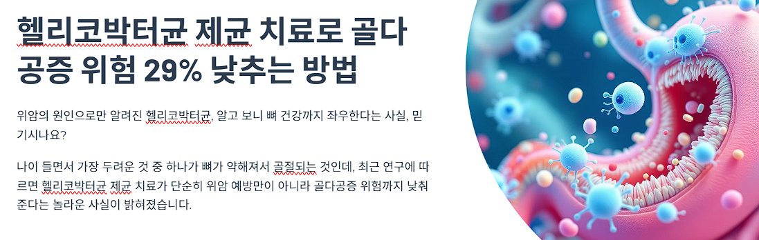 헬리코박터균 제균 치료로 골다공증 위험 29% 낮추는 방법