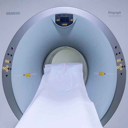 파킨슨병 진단방법