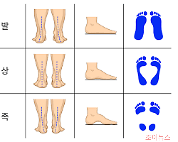 러닝화 고르는 3가지 꿀팁, 발 유형 파악