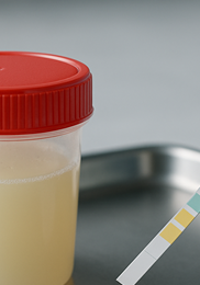 소변 색깔로 보는 건강 &amp;#124; 정상 색&amp;#44; 이상 신호&amp;#44; 병원 방문 기준