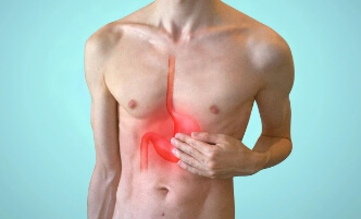 위궤양에 의한 속 쓰림 증상